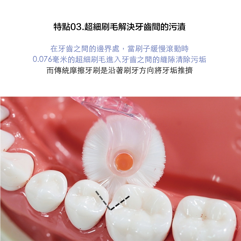 特點超細刷毛解決牙齒間的污漬在牙齒之間的邊界處,當刷子緩慢滾動時0.076毫米的超細刷毛進入牙齒之間的縫隙清除污垢而傳統摩擦牙刷是沿著刷牙方向將牙垢推擠